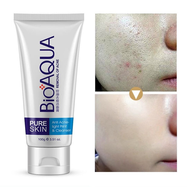 Bioaqua Skin Care Acne Face Removal Cleanser