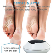 Ethereal New Original Electric Vacuum Adsorption Foot Grinder Pedicure