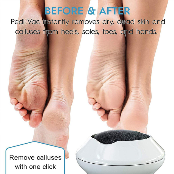 Ethereal New Original Electric Vacuum Adsorption Foot Grinder Pedicure