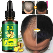 7 Day Ginger Germinal Oil  Hair Nutrient Solution Hair Growth Natural Hair Loss Treatment Hair Care (30ml)