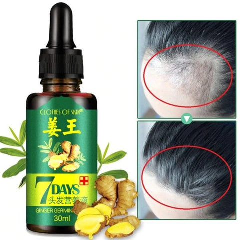 7 Day Ginger Germinal Oil  Hair Nutrient Solution Hair Growth Natural Hair Loss Treatment Hair Care (30ml)