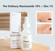 Niacinamide Skin Brightening Serum