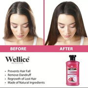 Deal Of 3 Wellice Deal Onion Shampoo Onion Oil ‘hair Mask Best Deal