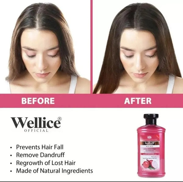 Deal Of 3 Wellice Deal Onion Shampoo Onion Oil ‘hair Mask Best Deal