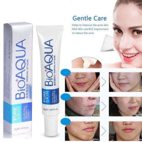 Bio Aqua Acne Cream Face Skin Care Acne Anti-Wrinkle Removal