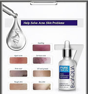 Eternity Bioaqua Face Acne Serum